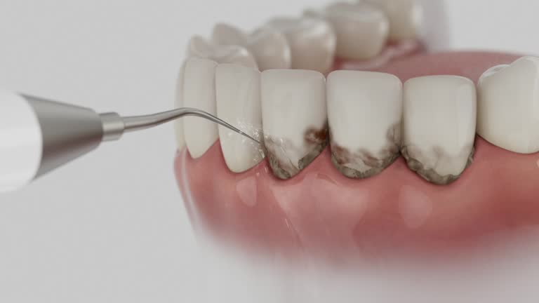 Reliable Teeth Cleaning And Checkup contractor in Polk County County, NC by Dentist Open Now